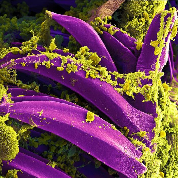 Colour micrograph obtained with a scanning electron microscope. On the grey-blue pointed spines lining the flea's proventriculus, a dense cluster of yellow rod-shaped Yersinia pestis bacteria – the plague pathogen – is visible. The bacteria form a dense mass that blocks the insect's digestive tract.